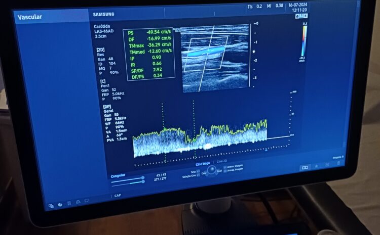  SANTA CASA REALIZA MUTIRÃO DE EXAMES DE ULTRASSOM NESTE SÁBADO (3)